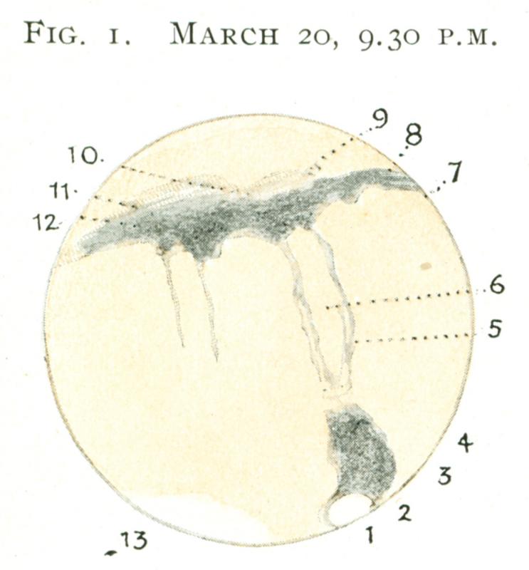 Mars 19180320-2130